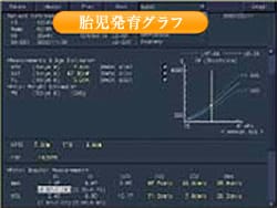 胎児発育グラフ